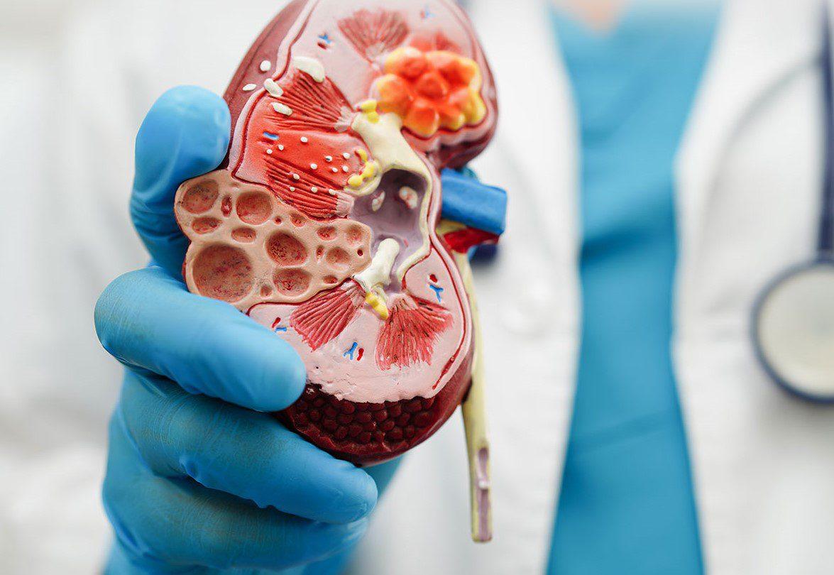 Top 10 Nephrology Companies in India